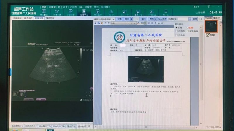 老年人体检，这几点不容忽视